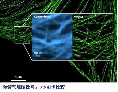 N-STORM 4.0超分辨率显微镜比较图.png